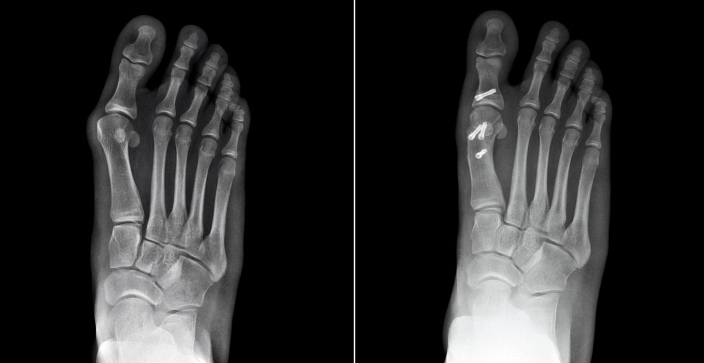Bureau de consultation médicale moderne avec négatoscope affichant une radiographie de pied, lumière naturelle abondante, environnement professionnel épuré